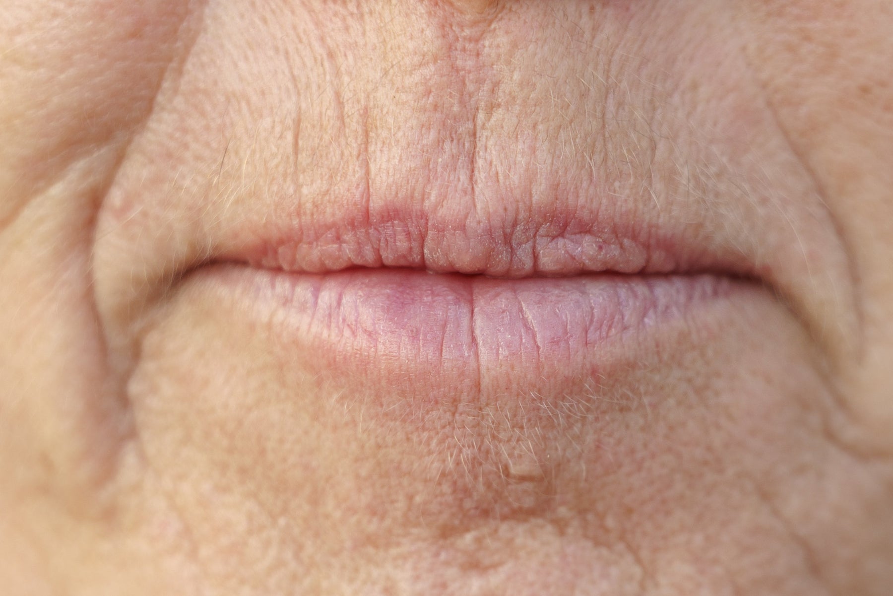 Teeth and the Ageing Face