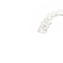 GRINDING YOUR TEETH: WHY IT'S A BIGGER PROBLEM THAN YOU MAY BELIEVE