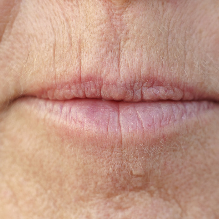 Teeth and the Ageing Face